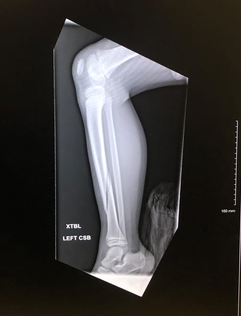 x-ray